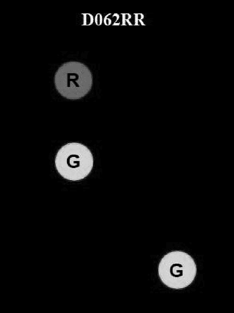 760. BOTH INTERNATIONAL & INLAND A vessel underway at night is displaying the lights shown in illustration D062RR below. What do these lights indicate?